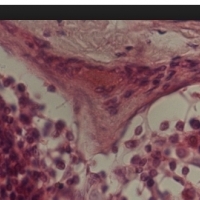Histologia. Tkanka łączna. Biologia.