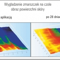 "Bez igieł, bez bólu" na noc z pięcioma kwasami. K714. BingoSpa. Zmniejsza zmarszczki, wygładza czoło.