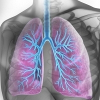 A bronchitis általában vírusos, nagyon gyakori légúti betegség.