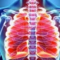 برونشیت اغلب یک بیماری تنفسی ویروسی بسیار شایع است.
