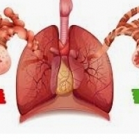 Il-bronkite hija ħafna drabi marda virali, komuni ħafna tas-sistema respiratorja.