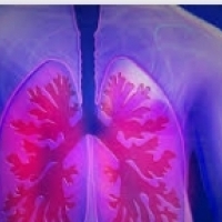 A bronquite é a miúdo unha enfermidade respiratoria vírica, moi común.