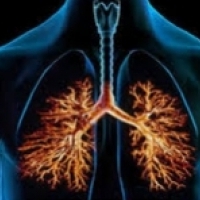 Bronhiit on enamasti viiruslik, väga levinud hingamisteede haigus.