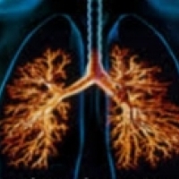支氣管炎最常見的是病毒性呼吸道疾病。