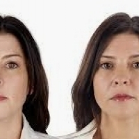 Capillaire huid: gezichtsverzorging en cosmetica voor capillaire huid.