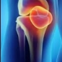 Kolagen untuk sendi lutut dan siku - perlu atau opsional?