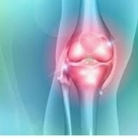 Kolagen kanggo sendi lutut lan sikut - perlu utawa opsional?