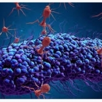 Modi di infezione da influenza e complicanze: Come difendersi dai virus: