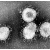 mRNA-1273: koronavīrusa vakcīna, kas gatava klīniskai pārbaudei: