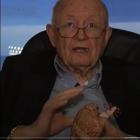 Ceremonia Misterium zamieniania głów i sklejania ciała z wielu kawałków. Transplantacje głów w XX wieku doktor Robert J White.