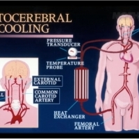 Die mysteriöse Zeremonie, Köpfe zu drehen und den Körper aus vielen Teilen zu kleben. Kopftransplantationen im  XX Dr. Robert J White.