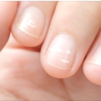 Sometimes nails indicate serious diseases