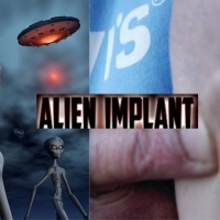ALIEN IMPLANTS - HAVE EVERYONE ON EARTH HAS BEEN CAPTURED BY A UFO?