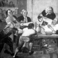 Robert Liston (1794-1847) był szkockim chirurgiem, który najbardziej znany jest z amputacji nogi pacjenta w czasie poniżej 2,5 minuty,.