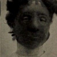 Maski z wulkanizowanej gumy były najczęstszą maską kosmetyczną w 1910 roku.