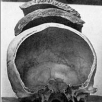 Grubość czaszki myśliwego z epoki prekolumbijskiej w stosunku do grubości czaszki człowieka żywiącego się produktami rolnymi.