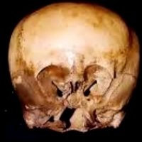 Genetycy udowodnili, ze czaszka Gwiezdnego Dziecka, nie jest całkowicie człowiekiem.