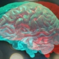 Implanty mózgu. Kontrowersyjny materiał w eksperymentach na ludziach.