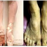 Tak wyglądają nogi naszych podziwianych balerin.