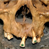 Starożytne ludy Majów nie tylko przyklejały klejnoty do zębów jako oznakę bogactwa.