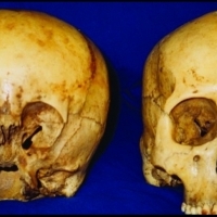 Wewnątrz znalazła ludzki szkielet, a na jego ramieniu trzymała się kość ręki innego szkieletu zakopanego pod ziemią.