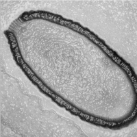 30 000-letni „gigantyczny” wirus został przywrócony przez naukowców do życia.