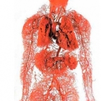 3 skutki zanieczyszczonych i zatkanych naczyń krwionośnych.