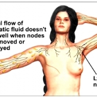 Lymph Nodes And Your Deodorant.