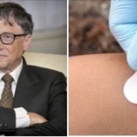 Finansowane przez Billa Gatesa badanie kliniczne plastra podawania leków i szczepionek, „Microneedle”.