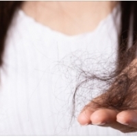 Jak zatrzymać wypadanie włosów czy łysienie ?