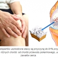 Jak naprawić uszkodzone stawy kolanowe: