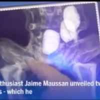 Jaime Maussan udowadnia prawdziwość mumii peruwiańskich.