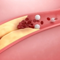 Czym jest cholesterol i co oznacza, że jest zły?